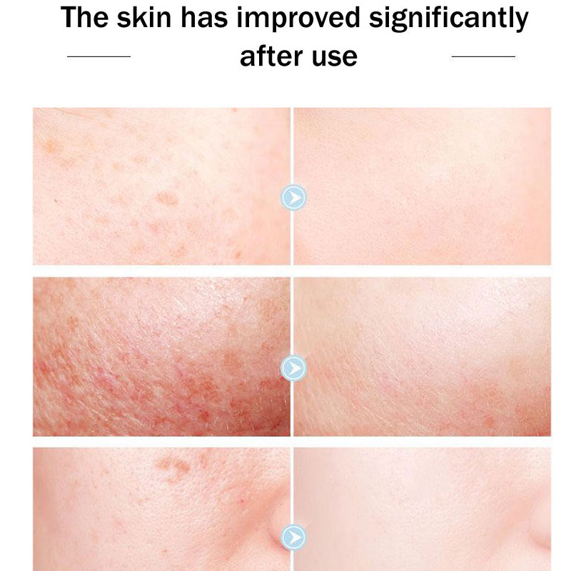 Original Queen Brand Face Crea - Skincare Queen review and price