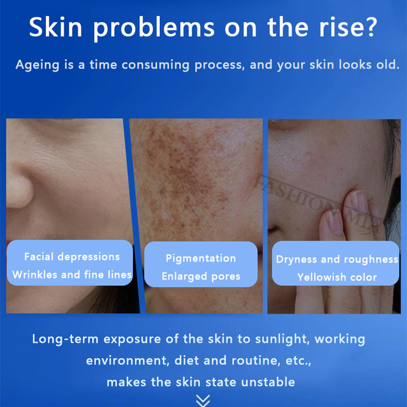 80% Blue Sponge microalgae Kit - Hyaluronic Acid Serum review and price
